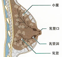 乳がんってどんな病気?